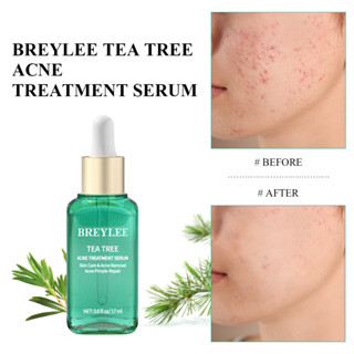 Breylee Tea Tree Acne Essence เอสเซ้นบํารุงผิวหน้า ลดสิว 17 มล.