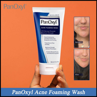 PanOxyl Acne Foaming Wash 10% Benzoyl Peroxide Maximum Strength 156g Antimicrobial โฟมล้างหน้า โฟมล้างหน้าสิว สบู่ล้างหน้า