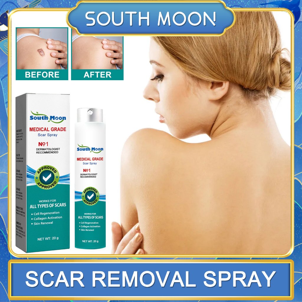 Remover สเปรย ์ ซ ่ อมแซม Stretch Mark Firming Body Treatment Streak โรคอ ้ วนปรับปรุงผิวเรียบเนียนส ่ งเสริม Activatio Care