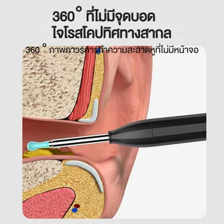 Dr.isla P2 มองเห็นได้ ช้อนหู กล้อง ช้อนหู ไม้แคะหู มี กล้อง น้ำยาทำความสะอาดรูหู น้ำยาล้างหู HD สามารถดูได้ 360 องศา PK Bebird