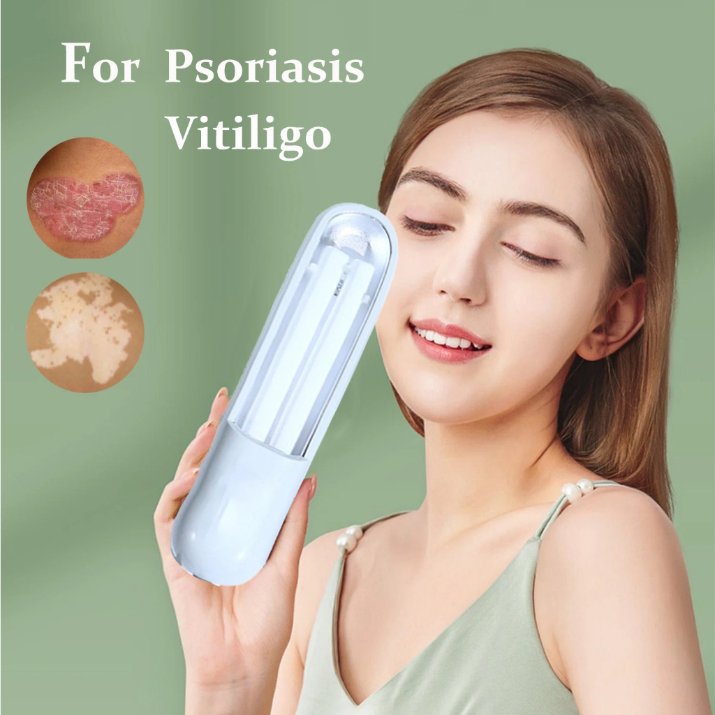 Psoriatic Vitiligo Led Uvb Light Therapy แคบ 311nm Uvb Light Therapy Uvb Light Therapy