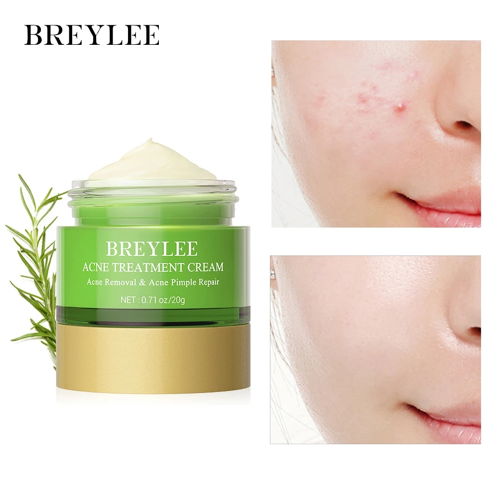 Breylee ครีมบํารุงผิวหน้ากําจัดสิวควบคุมความมัน 20กรัม