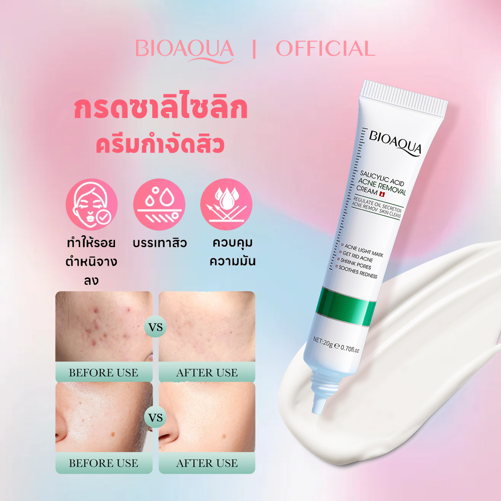 BIOAOUA ครีมกําจัดสิว กรดซาลิซิลิก ลดเลือนรอยสิว ครีมรักษาสิว เจลรักษาสิว 20g