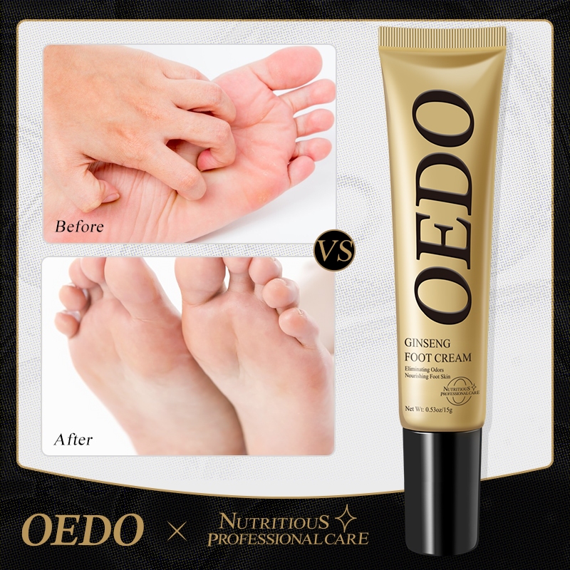OEDO โสมเล็บ ครีมบํารุงเล็บป้องกันการเชื้อราสําหรับดูแลเล็บเท้า ครีมบำรุงเท้า 15 กรัม