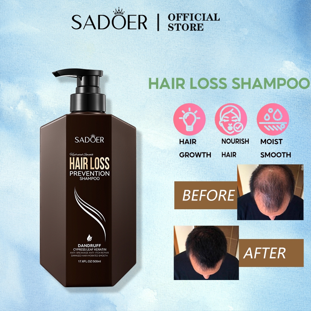 SADOER Hair Loss Prevention Shampoo 500ml แชมพูปลูกผม ป้องกันผมร่วง ซ่อมแซมหนังศีรษะเสีย