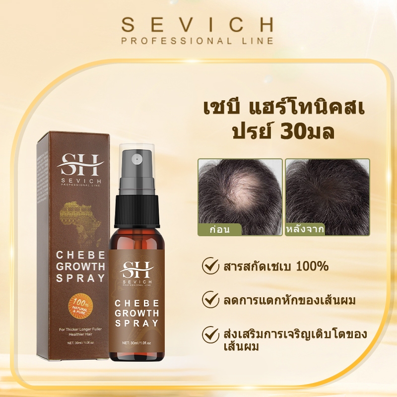 Sevich Chebe สเปรย์ปลูกผม ลดผมแตก เพิ่มความแข็งแรง 30 มล.