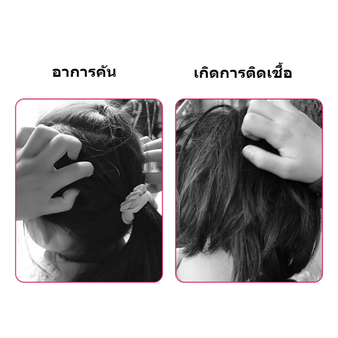 [ซื้อ 1 แถม 1] หวีสางเหาไข่เหาก็หวีได้หมดขจัดเหาเป็นเรื่องง่ายเครื่องดูดเหา หวีเหาสางไข่เหาหวีดูดเหากำจัดเหาหวีเสนียดไฟฟ ราคา ถูกที่สุด ดีลบีเคเค แกลเลอรีภาพที่ 7
