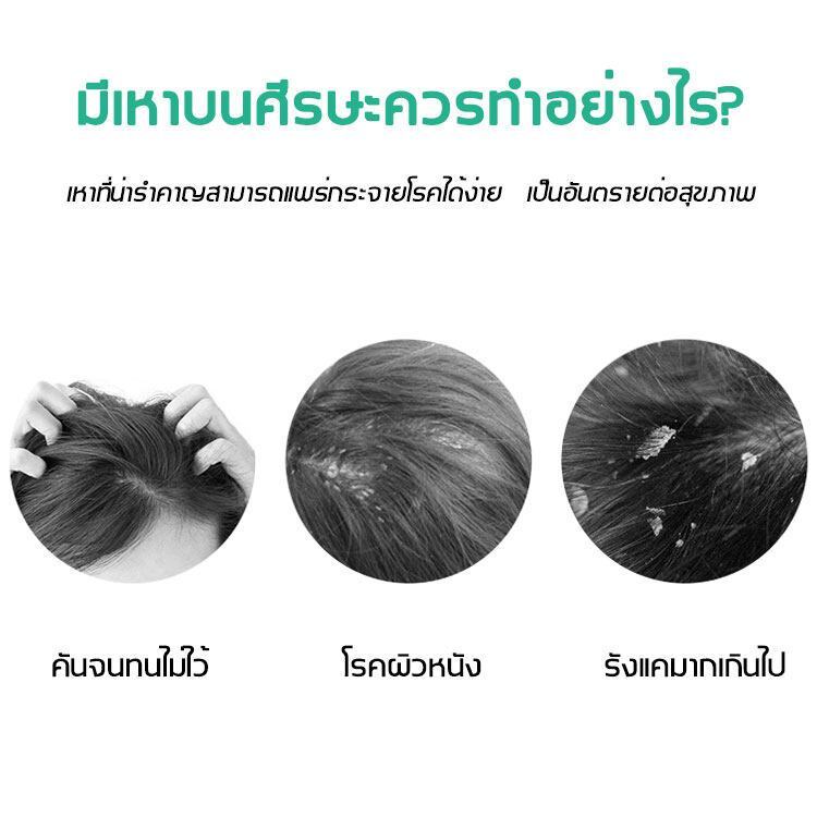 [ซื้อ 1 แถม 1] หวีสางเหาไข่เหาก็หวีได้หมดขจัดเหาเป็นเรื่องง่ายเครื่องดูดเหา หวีเหาสางไข่เหาหวีดูดเหากำจัดเหาหวีเสนียดไฟฟ ราคา ถูกที่สุด ดีลบีเคเค แกลเลอรีภาพที่ 6