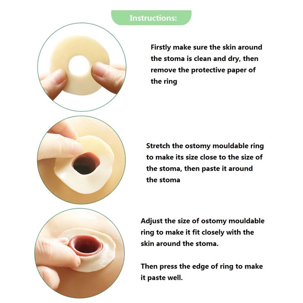 10 ชิ ้ น BDM 2 มม.Ostomy วางแหวน , ยืดสร ้ างเพื ่ อป ้ องกันการรั ่ วซึม , ป ้ องกันการรั ่ วซึม - รูปที่ 3