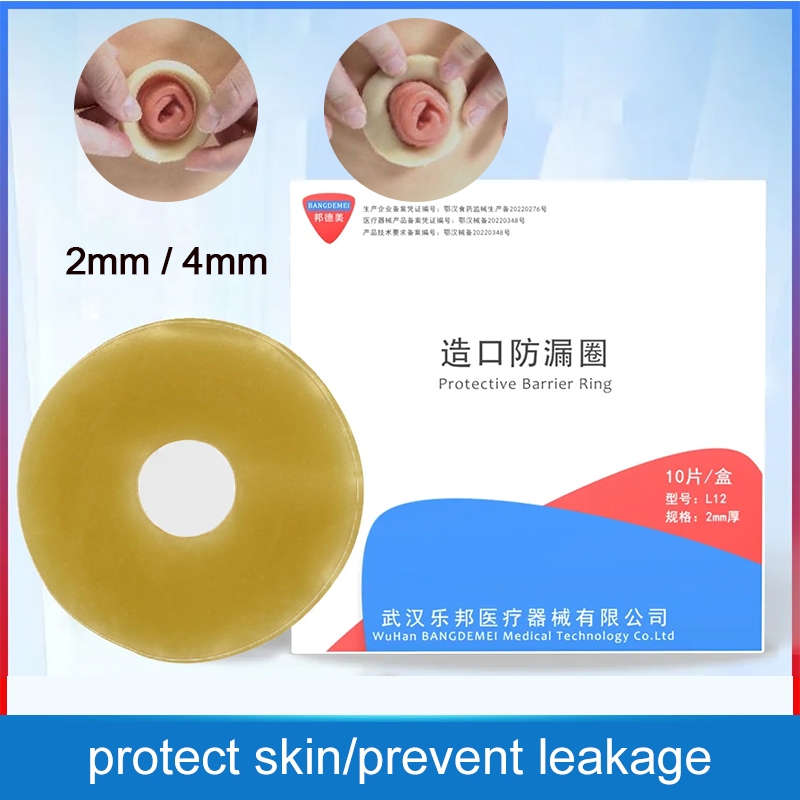 10 ชิ ้ น BDM 2 มม.Ostomy วางแหวน , ยืดสร ้ างเพื ่ อป ้ องกันการรั ่ วซึม , ป ้ องกันการรั ่ วซึม