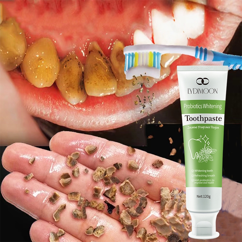 ยาสีฟันฟอกฟันขาว ยาสีฟัน ดีเดนท์ ฟอกฟันขาว 120g ของแท้ 100% ยาสีฟัน ฟอกฟันขาว ขจัด หินปูน LYDIMOON ย