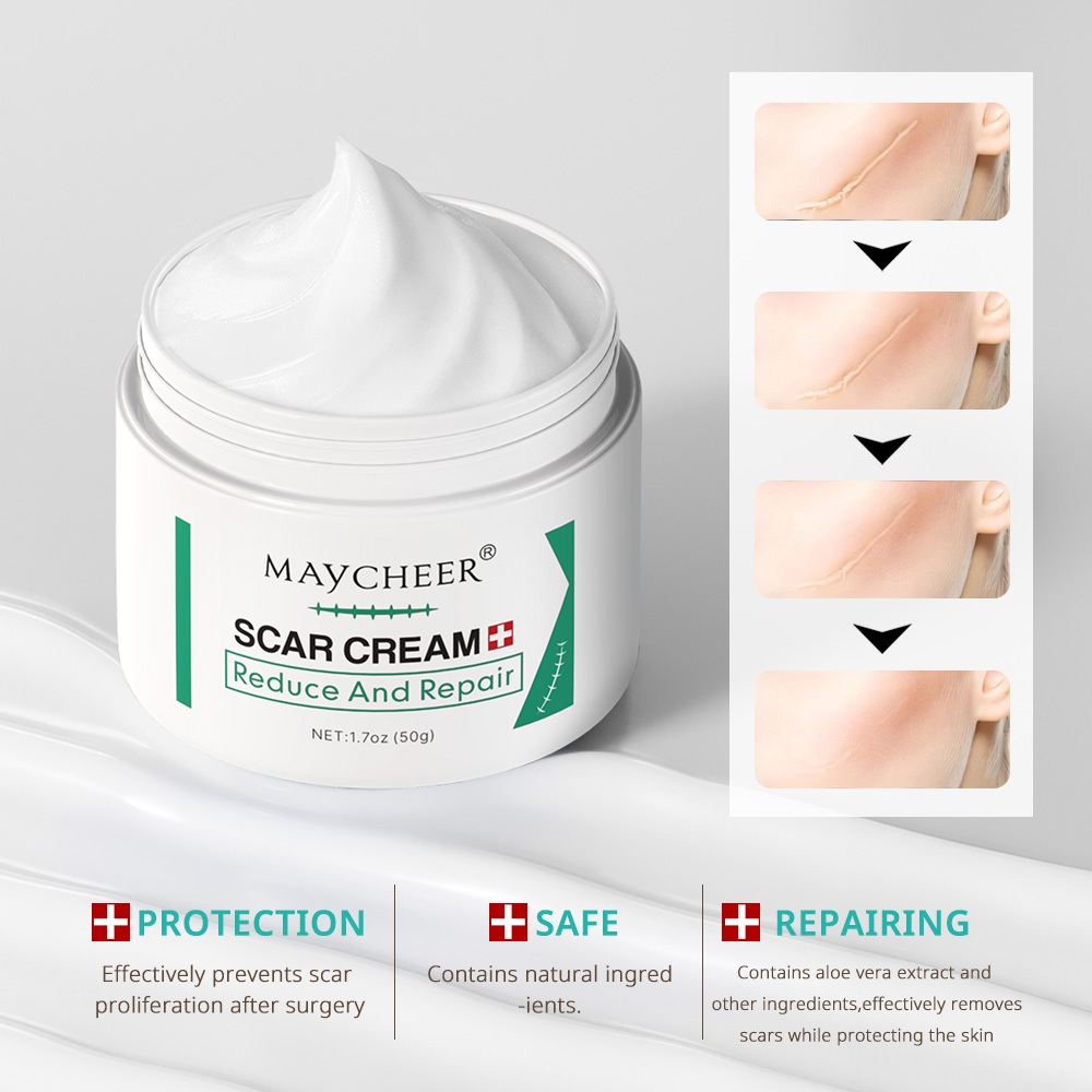 Acne Scar Remover Old Scar Scarminator Cream Strech Mark Remover รอยแผลเป็นกําจัด Pimple Mark Remove