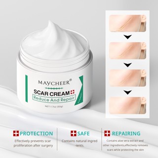 Acne Scar Remover Old Scar Scarminator Cream Strech Mark Rem…