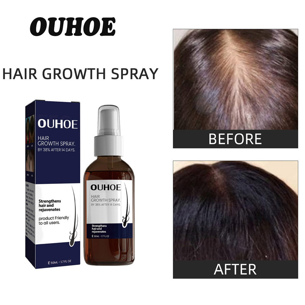 50ml OUHOE Hair Growth Spray บํารุงการพัฒนาอย ่ างรวดเร ็ วและป ้ องกันผมร ่ วงควบคุม Treatment Serum Hair Care Hair Growth Liquid