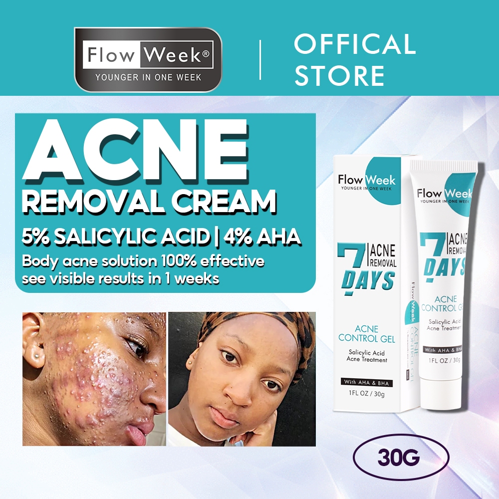 Flowweek Acne Spot Gel Salicylic Acid Acne Cream Removal Pimple Eraser Spot Care 30g