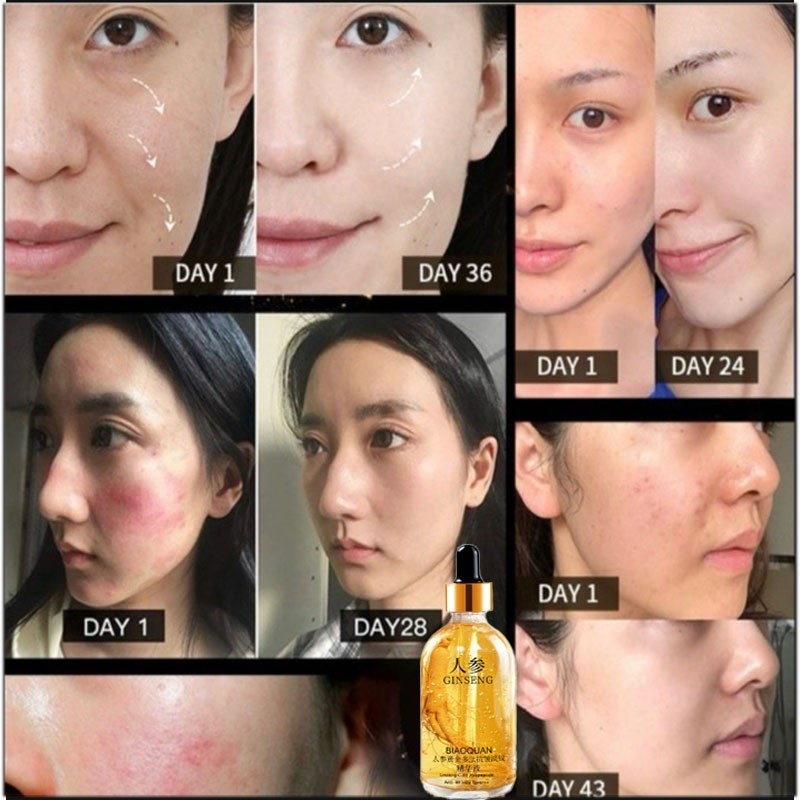 SEVICH เอสเซนส์โสม ต่อต้านริ้วรอย ฟื้นฟูผิว เอสเซนส์น้ํา กระจ่างใส ชุ่มชื้น และกระจ่างใส