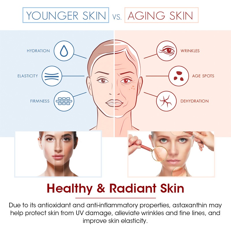 Alliwise Astaxanthin แคปซูล 10 มก . พร ้ อมน ้ ํามันปลาสําหรับสารต ้ านอนุมูลอิสระตามธรรมชาติ , ปรับปรุงสุขภาพผิว , สุขภาพตา , บรรเทาอาการอักเสบ - รูปที่ 2