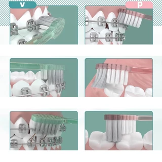 MEYARN 2 ชิ้น P V แปรงสีฟันสำหรับคนจัดฟัน แปรงซอกฟัน ขนแปรงนุ่ม ไม่ทำให้เหงือกเจ็บ จัดฟัน