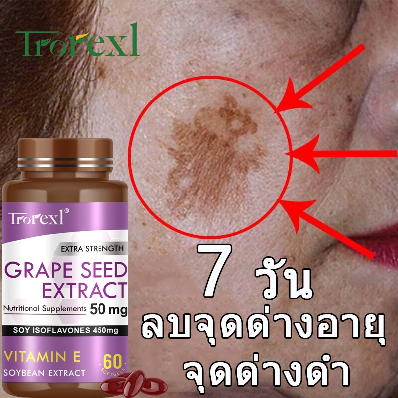 Trorexl Natural Grape Seed Extract Procyanidins Anti-Spot Capsules - จุดด่างดำหายไปภายใน 7 วัน - เหมาะสำหรับผู้ที่มีปัญหาฝ้า กระ และจุดด่างดำ
