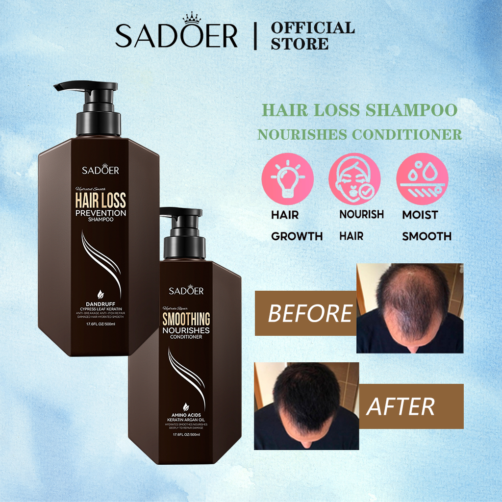 SADOER Hair Loss Prevention Shampoo แชมพู ป้องกันผมร่วง รังแค คันหนังศรีษะ นุ่มลื่น ผมดูสุขภาพดีเงางาม ผลิตภัณฑ์ดูแลผม (แชมพู & ครีมนวด)