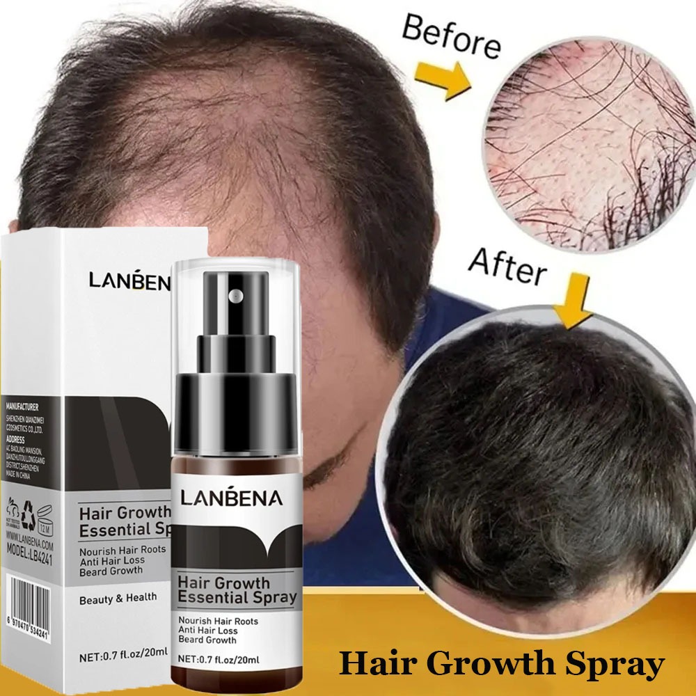LANBENA Hair Growth Essence Spray สเปรย์เอสเซ้นเจริญเติบโตของเส้นผม
