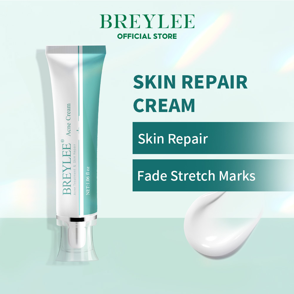 Breylee Scar Remover Cream Acne Treatment Whitening Moisturizer Skin Care 30g