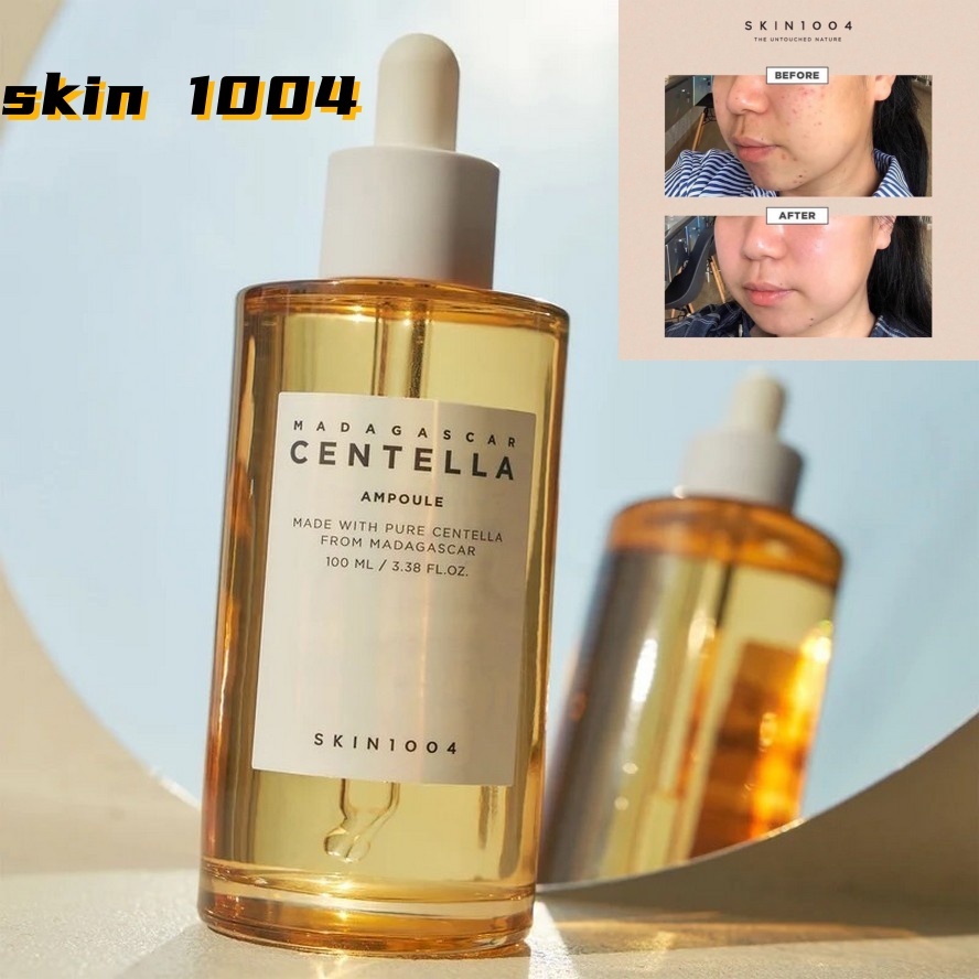 【แท้ 100%】 Skin1004 Madagascar Centella Ampoule Whitening Serum 100ML เอสเซ้นซ์ เดลี่แคร์ เซรั่มบํา
