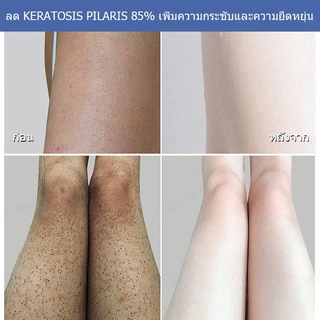 Sevich อาบน้ําถูไม่เจ็บปวดอาบน้ําทาวเวอร์รอบเค้กอุปกรณ์อาบน้ําดูแลผิว