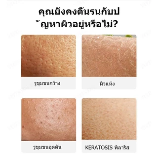 Sevich อาบน้ําถูไม่เจ็บปวดอาบน้ําทาวเวอร์รอบเค้กอุปกรณ์อาบน้ําดูแลผิว