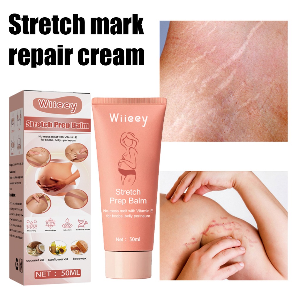Stretch Marks Repair Cream Skin Care Scar and Pregnancy ริ้วรอย Removing Cream ระหว่างตั้งครรภ์