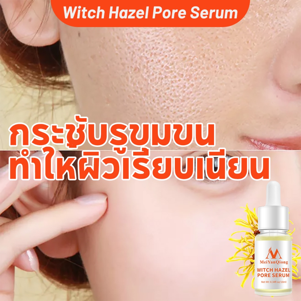 MeiYanQiong FDA เซรั่มหน้าใส เซรั่มบำรุงผิวหน้า กระชับรูขุมขน ผิวหน้าสว่างกระจ่างใส เติมความชุ่มชื้น