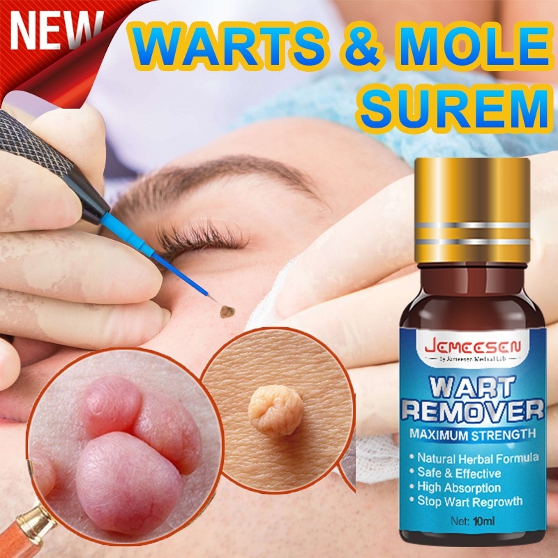 Jemeesen Natural Wart Remover Liquid Original Wart Medicine Mole Remover Skin Tag Remover Wart Fat Remover ไม่มีผลด้านข้าง 100% Wart Removal