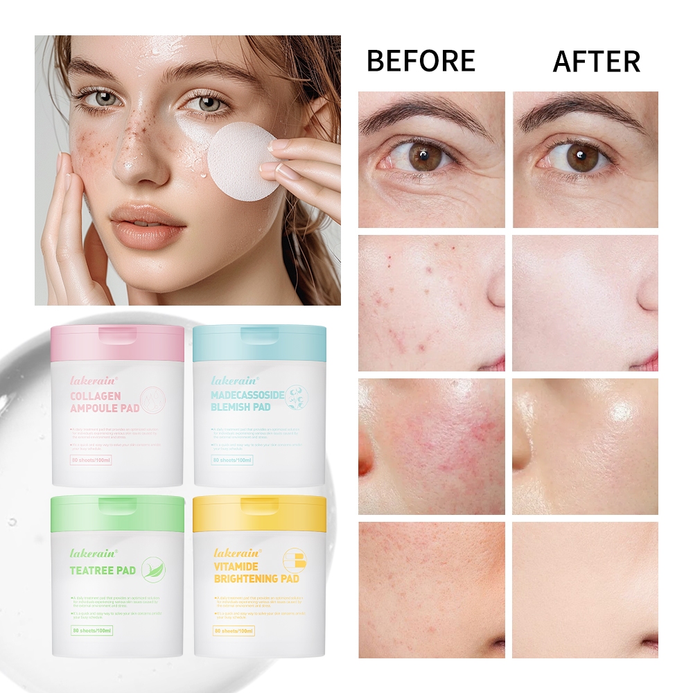 แผ่นโทนเนอร์ Lakerain สําหรับใบหน้า, Teatree Trouble Toner Pad,Madecassoside Blemish ,Vitamide Brightening Pad,Soothing Cotton Pads สําหรับ Sensitive & Acne Prone Skin ราคา ถูกที่สุด ดีลบีเคเค แกลเลอรีภาพที่ 5