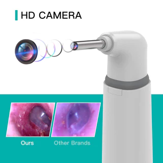 Digital Endoscope Otoscope กล้องหูโทรศัพท์มือถือแท็บเล็ต