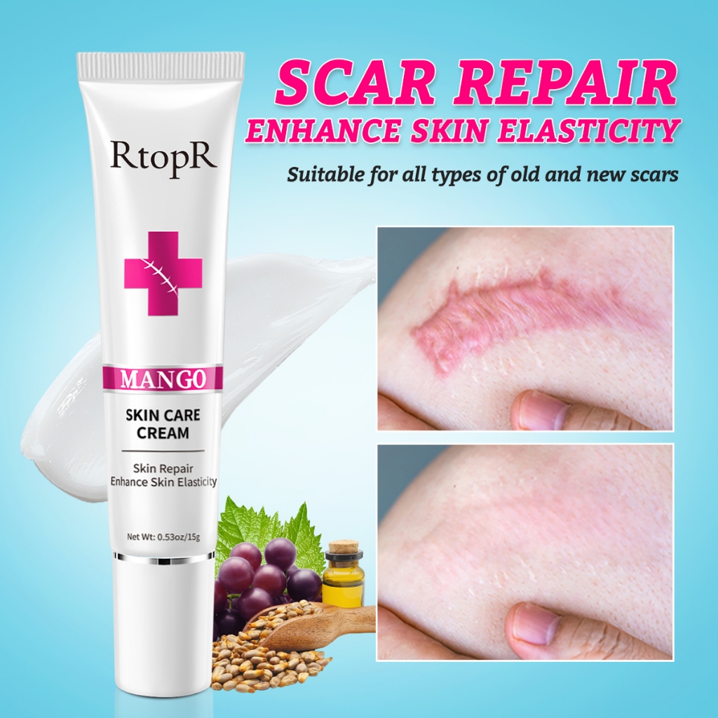 RtopR Scar Removal Cream Nourishing Moisturizing Skin Scar Repair Marks Removal 15g