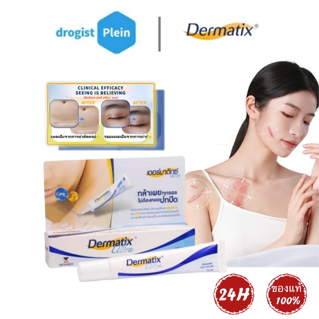 ซื้อ Dermatix Ultra Gel เดอร์มาติกซ์ อัลตร้า เจลลดรอยแผลเป็น ขนาด 15g