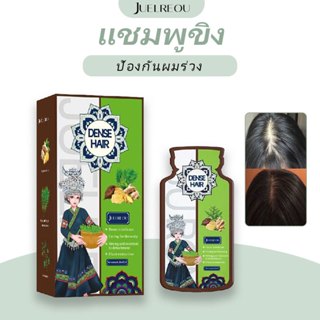 แชมพูป้องกันการหลุดร่วงจากสารสกัดขิง สำหรับผู้ที่มีเส้นผมและ…