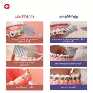 YANDY แปรงสีฟันสำหรับคนจัดฟัน ขนแปรงนุ่มพิเศษ ทำความสะอาดซอกฟันลึก ไม่ติดลวด ไม่ทรมานเหงือก