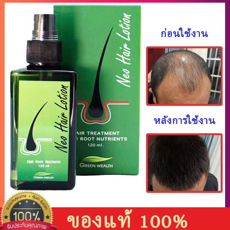 【บรรจุภัณฑ์ใหม่】Neo Hair Lotion120ml🔥สเปรย์ปลูกผม นีโอแฮร์ เซรั่มปลูกผม น้ำยาปลูกผม ป้องกันผมร่วง เร