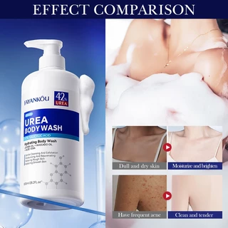 FAYANKOU Urea Shower Gel เจลอาบน้ำยูเรีย ให้ความชุ่มชื้น ทำความสะอาดล้ำลึก ลดสิว กำจัดไร พร้อมให้ความชุ่มชื้น ขนาด 800ml
