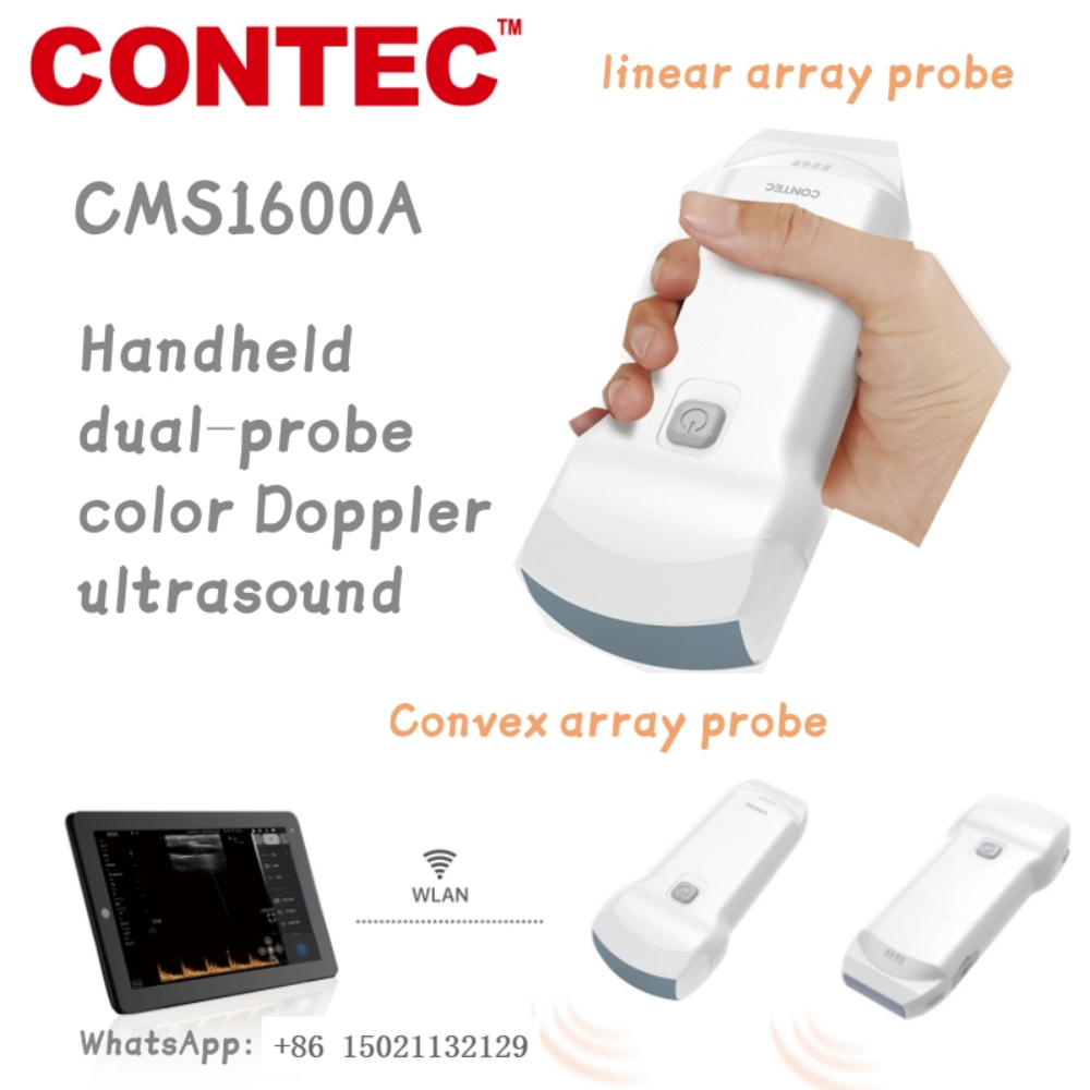 CONTEC CMS1600A มือถือ dual-probe สี Doppler ระบบวินิจฉัยอัลตราซาวนด์ B, B/M, C, PW ทํางานโหมด MACHINE