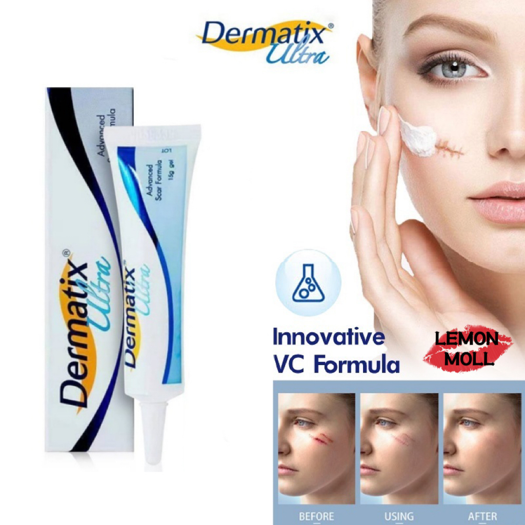 【ซื้อ 1 แถม 1 ฟรี】Dermatix Acne Scar Dragon Blood Dermatix Ultra Scar Gel แผลเป็น ยาทาแผลเป็น 15g