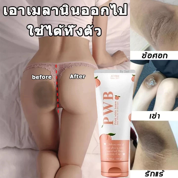[ ของแท้ ] pwb lotion ครีมทาก้น ลดรอยแตก รอยดำ ก้นเนียน รอยแผลเป็นน้ำเหลืองไม่ดี ขนาด 120mlPWB