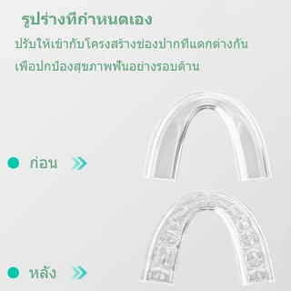 MEYARN ยางครอบฟันลดอาการนอนกัดฟันขณะนอนหลับ ป้องกันการกัดฟันทันตกรรมยามค่ําคืน