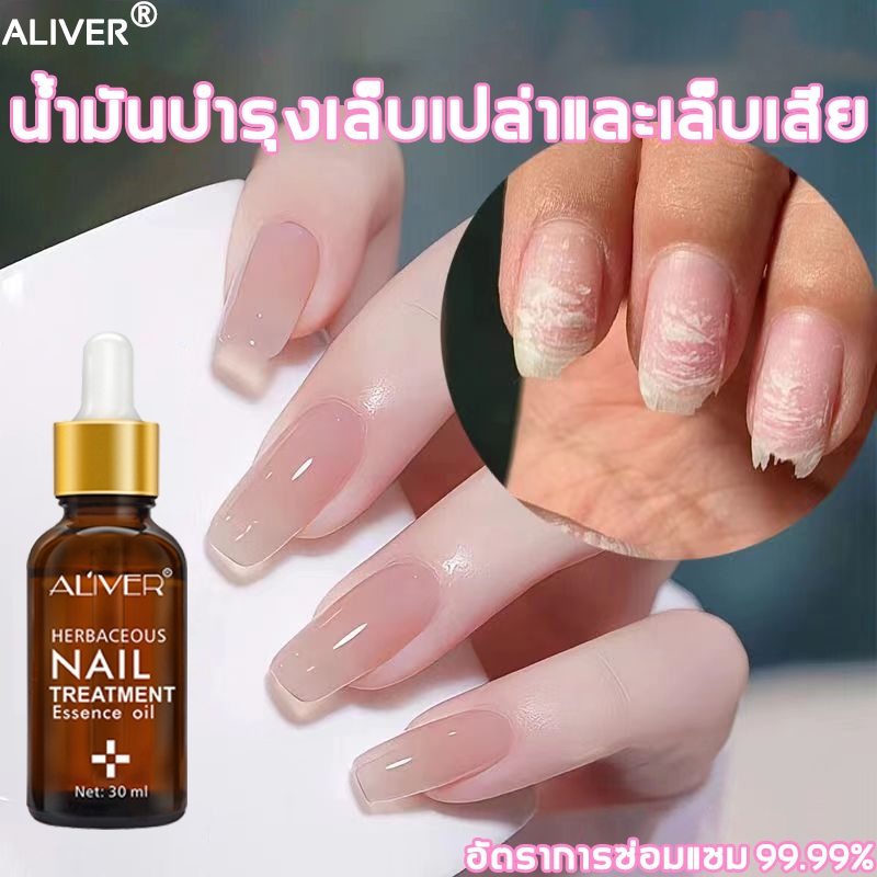 ALIVER เซรั่มบำรุงเล็บ เซรั่มเล็บ เล็บขบ เชื้อรา 30ml บำรุงเล็บ เชื้อราเล็บมือ ลากับเล็บเสีย ห่างกับปัญหาเล็บ ซ่อมแซมเล็บ ราคา ถูกที่สุด ดีลบีเคเค