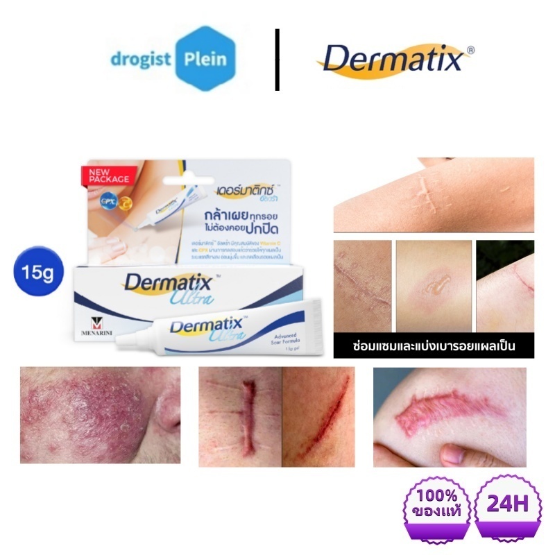 【แท้100% 】Dermatix Ultra Gel เดอร์มาติกซ์ อัลตร้าเจล เจลลดรอยแผลเป็น เดอมาติก เจลซิลิโคน ขนาด 15กรัม