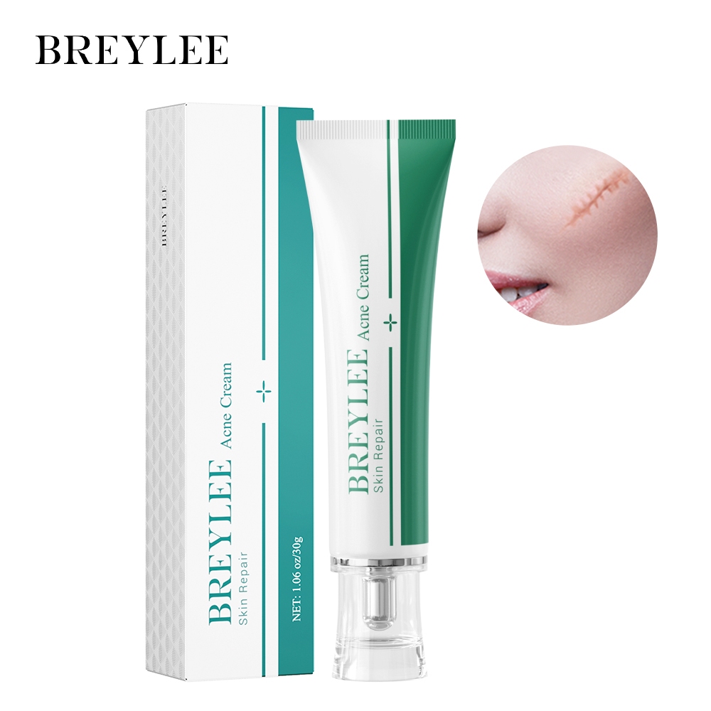 BREYLEE ครีมลบรอยแผลเป็น Scar Removal Gel 30g ครีมลดรอยแผลเป็น ลดผิวแตกลาย ลบรอยแผลเป็น ลดเลือนป้องกันรอยแผลเป็น