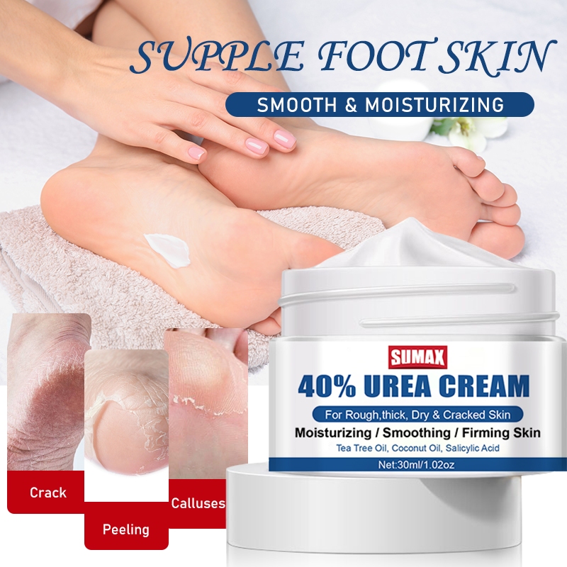 30ml Urea Cream 40%-Intensive Hydration สําหรับส้นเท้าแตก เท้า มือ ข้อศอก และเข่า -Foot Moisturizing Cream Hand Care Cream Anti-Cracking Anti-Drying Softness