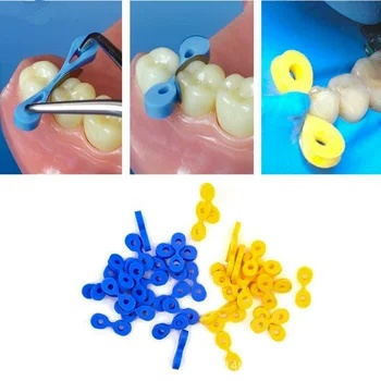 60 ชิ้น/กล่อง Interdental Wedge ทันตกรรม Wedge ฟันแยกยาง Matrix อุปกรณ์ทันตแพทย์