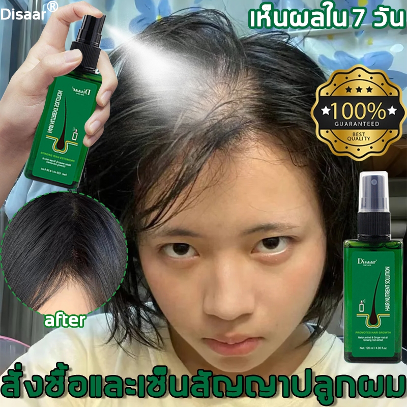 ☘️เห็นผลภายใน 7 วัน☘️เซรั่มปลูกผม น้ำยาปลูกผม120ml บอกลาหัวล้าน ป้องกันผมร่วง